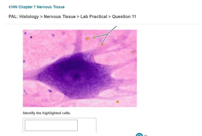 Nervous histology answers neurons sens